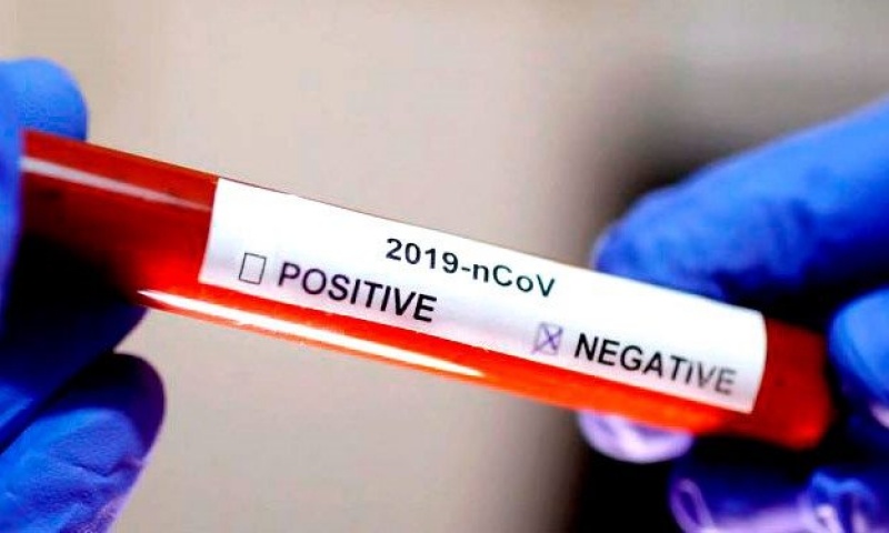 Brasil sofre avanço rápido da Covid-19 e hospitais de vários estados em pleno colapso. Faltam leitos de UTIs