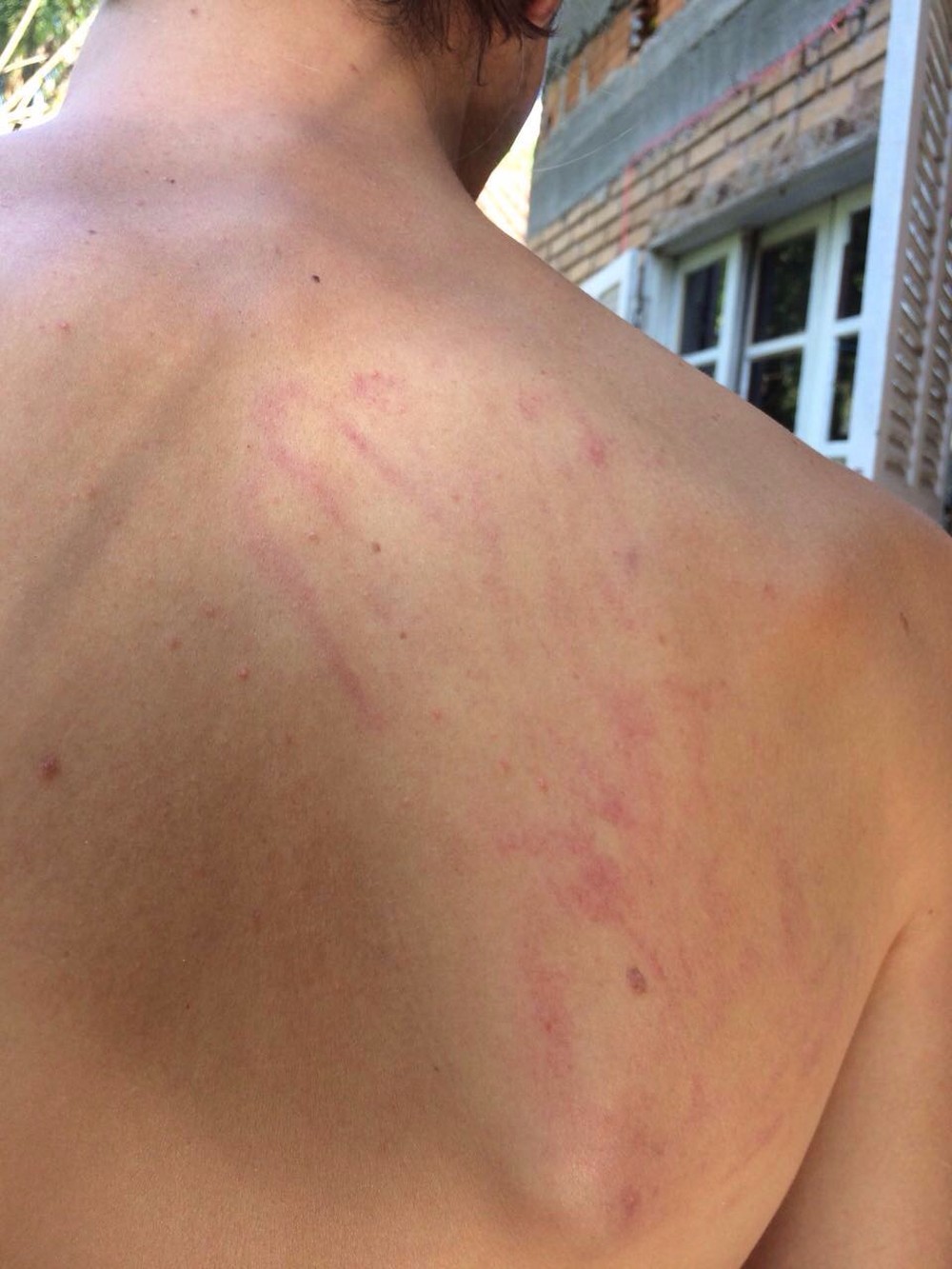 Jovens afirmam ter sofrido homofobia e são expulsos de shopping de Florianópolis